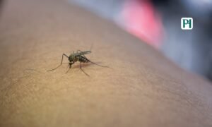 Dengue Fever Early Symptoms
