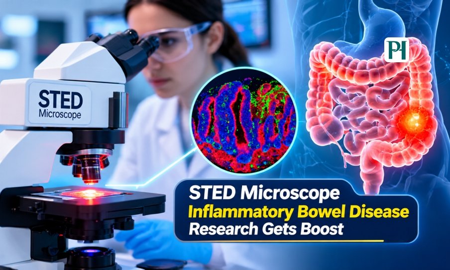 STED Microscope Inflammatory Bowel Disease Research Gets Boost